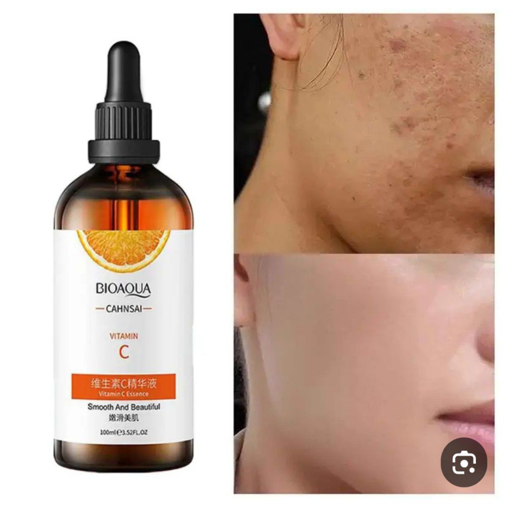 فروش عمده سرم ویتامین سی بیوآکوا اصل خارجی کد 131092