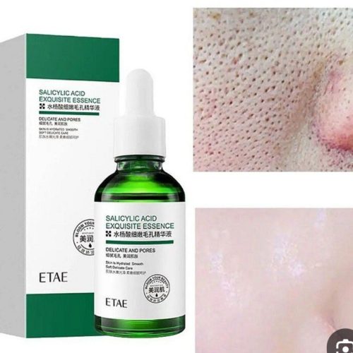 فروش عمده سرم ضد جوش سالیسیلیک اسید ایتی ای ️ کد 130940