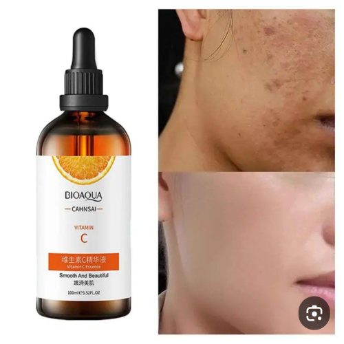 فروش عمده سرم ویتامین سی بیوآکوا اصل خارجی کد 131092